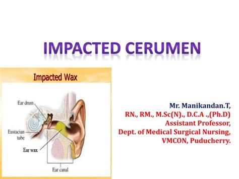 cerumen impaction test|cerumen impaction definition.